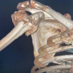 Premieră medicală la SJUP (4)